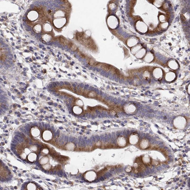 PLEKHB2 Antibody in Immunohistochemistry (Paraffin) (IHC (P))