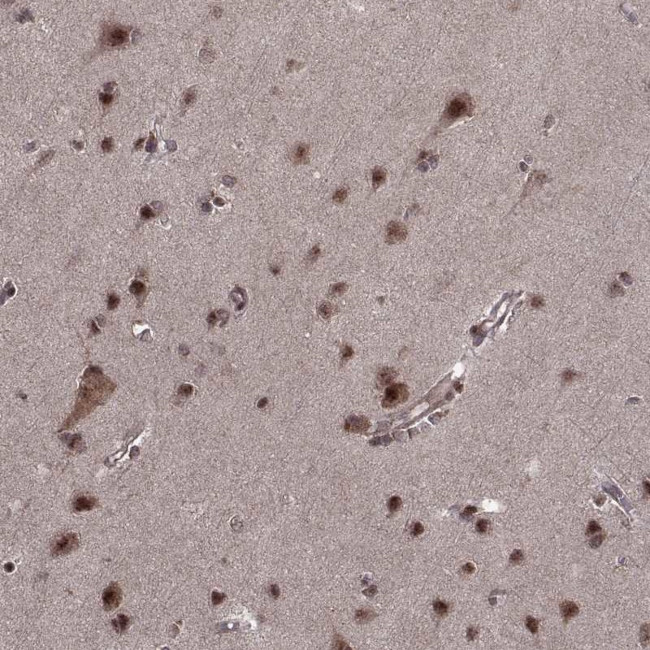 PTOV1 Antibody in Immunohistochemistry (Paraffin) (IHC (P))