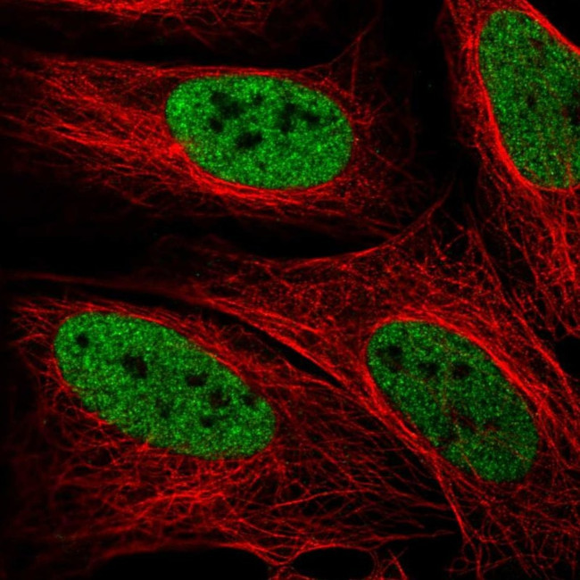 ZMYM3 Antibody in Immunocytochemistry (ICC/IF)