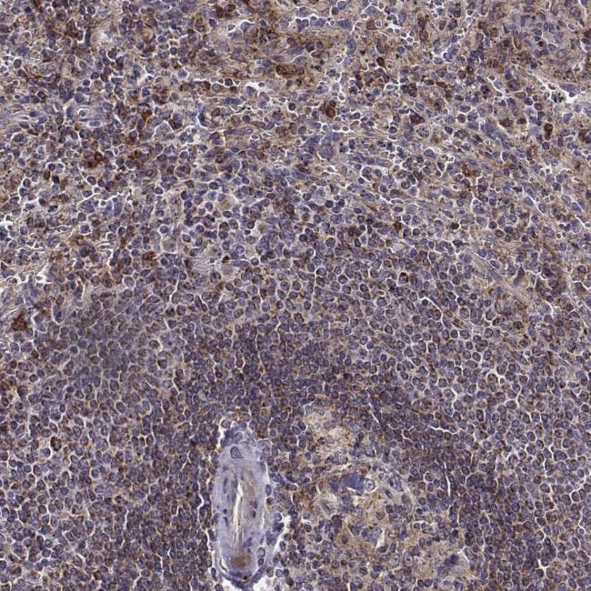 MTSS1 Antibody in Immunohistochemistry (Paraffin) (IHC (P))