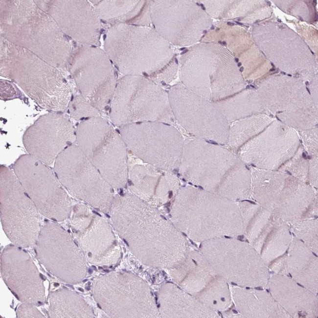 RhoF Antibody in Immunohistochemistry (Paraffin) (IHC (P))