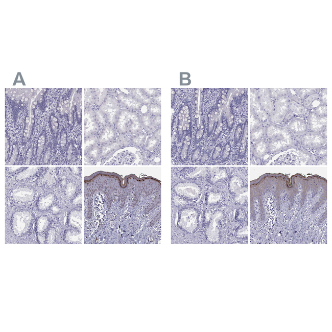 LOR Antibody in Immunohistochemistry (Paraffin) (IHC (P))
