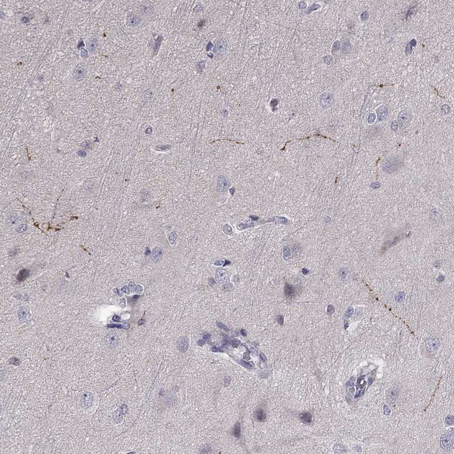Norepinephrine Transporter Antibody in Immunohistochemistry (Paraffin) (IHC (P))