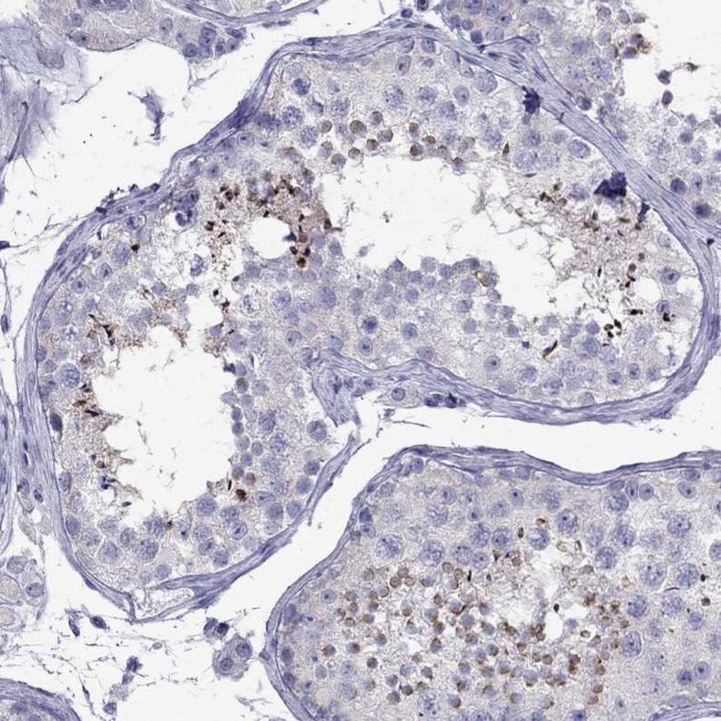 PATE1 Antibody in Immunohistochemistry (Paraffin) (IHC (P))