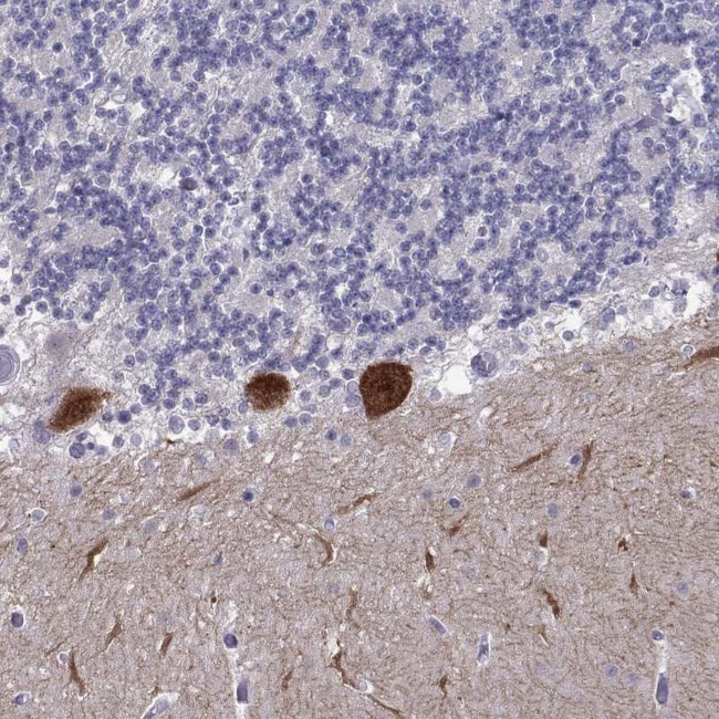 RGS8 Antibody in Immunohistochemistry (Paraffin) (IHC (P))