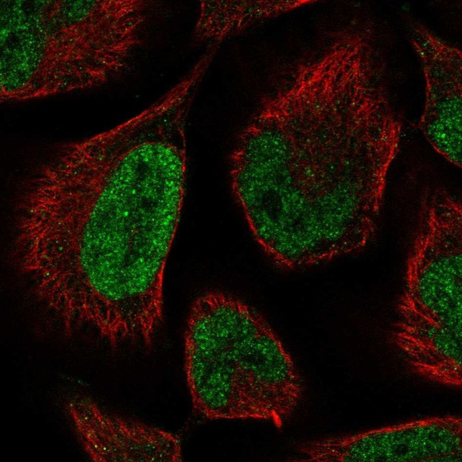 LCOR Antibody in Immunocytochemistry (ICC/IF)