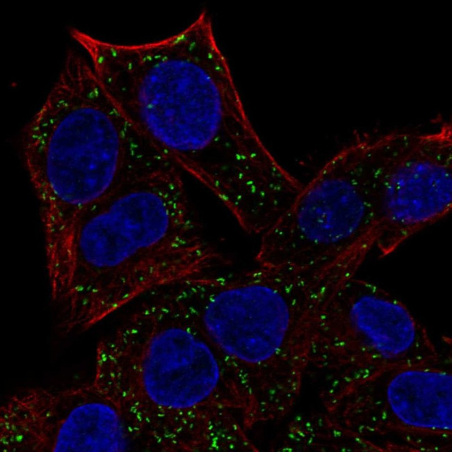 ABT1 Antibody in Immunocytochemistry (ICC/IF)
