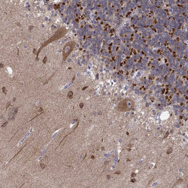 LMTK3 Antibody in Immunohistochemistry (Paraffin) (IHC (P))