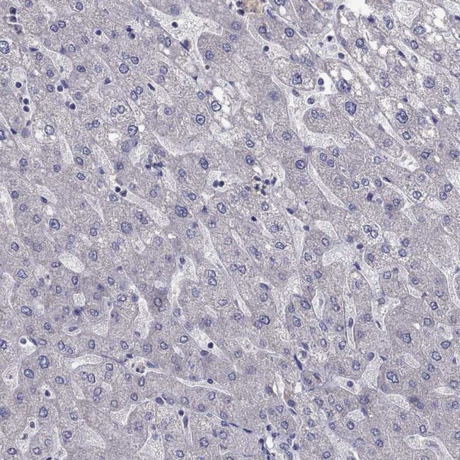 LRRC39 Antibody in Immunohistochemistry (Paraffin) (IHC (P))