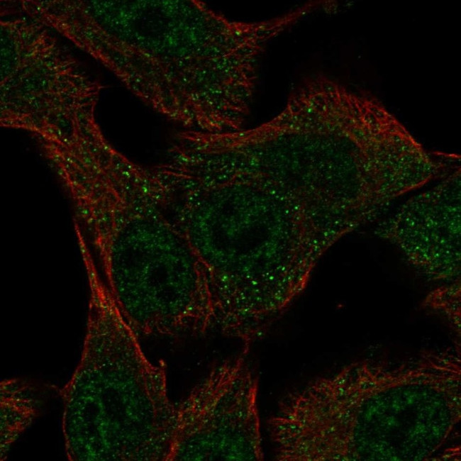 SLC43A3 Antibody in Immunocytochemistry (ICC/IF)