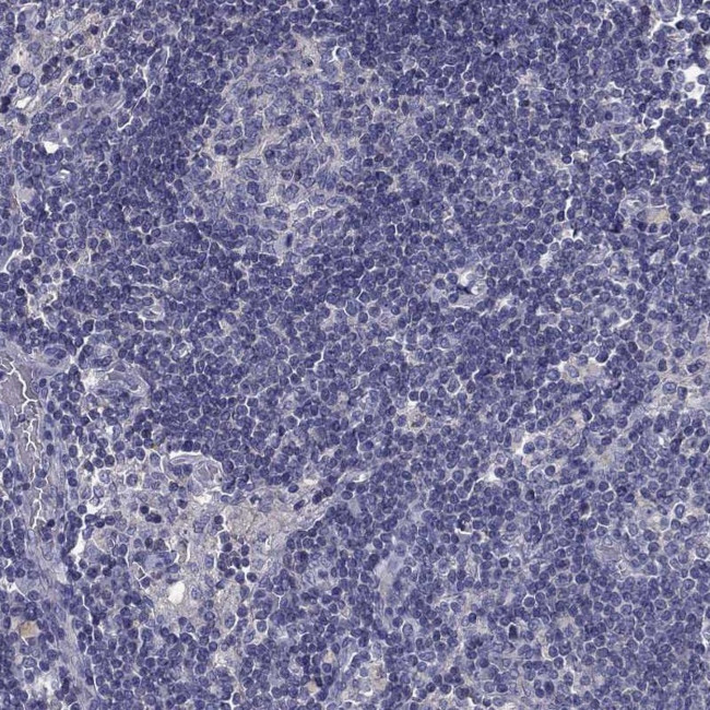 PRR18 Antibody in Immunohistochemistry (Paraffin) (IHC (P))