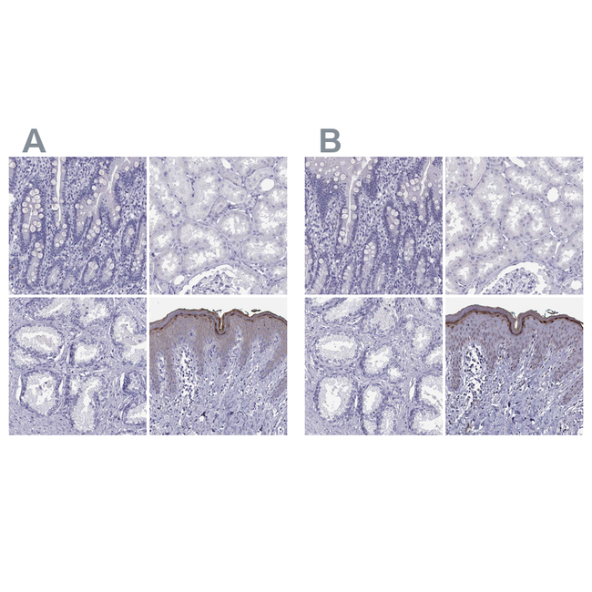 LOR Antibody in Immunohistochemistry (Paraffin) (IHC (P))