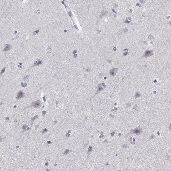 DOK3 Antibody in Immunohistochemistry (Paraffin) (IHC (P))