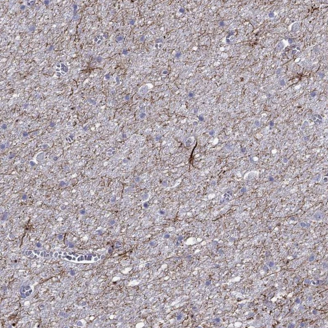 TMEM155 Antibody in Immunohistochemistry (Paraffin) (IHC (P))