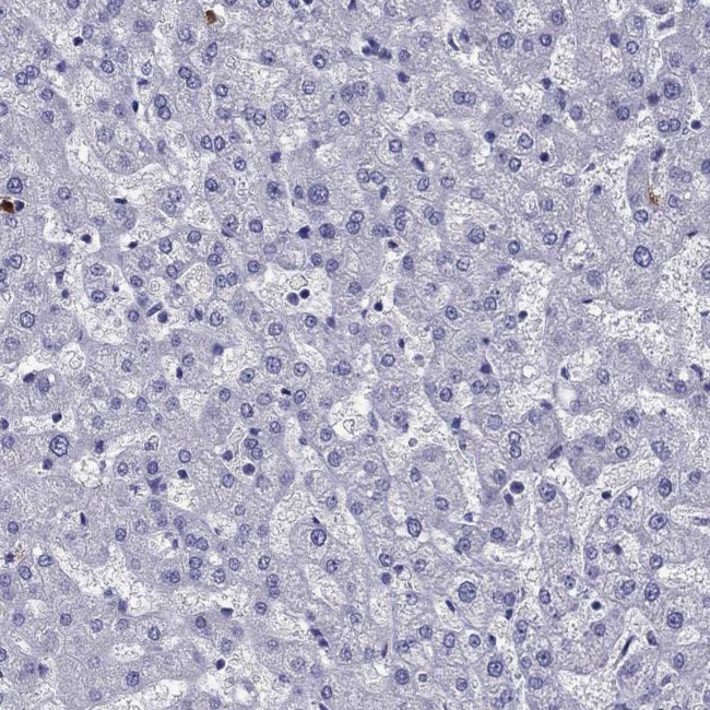 OLFM4 Antibody in Immunohistochemistry (Paraffin) (IHC (P))