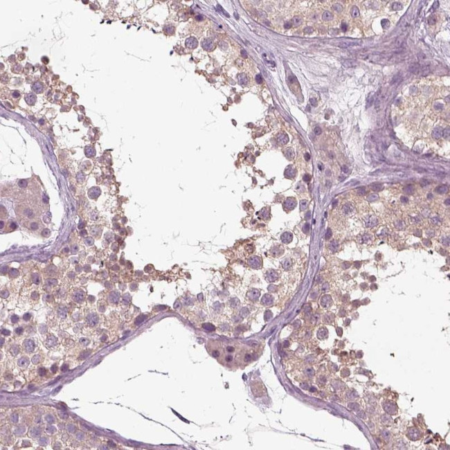 RND2 Antibody in Immunohistochemistry (Paraffin) (IHC (P))