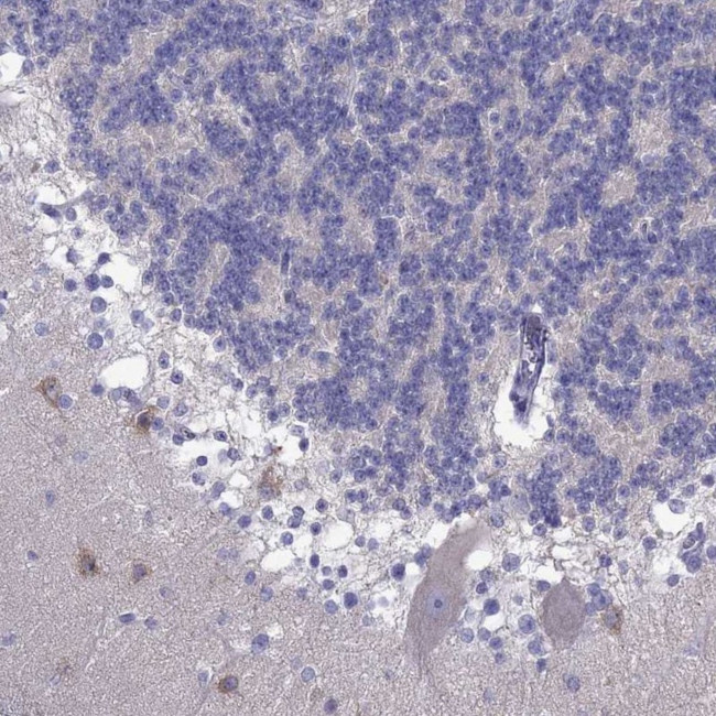 PCDHA6 Antibody in Immunohistochemistry (Paraffin) (IHC (P))
