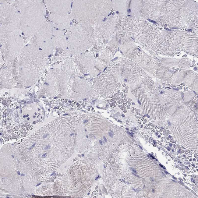 Kir4.1 (KCNJ10) Antibody in Immunohistochemistry (Paraffin) (IHC (P))