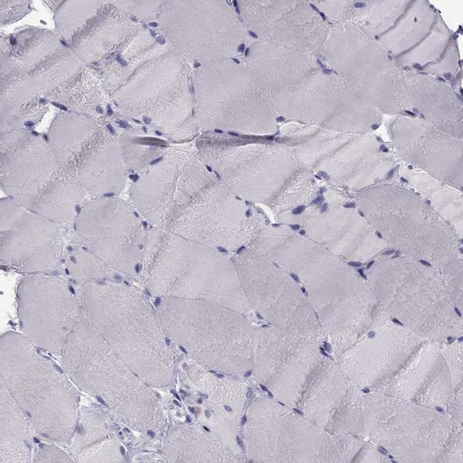 Synaptotagmin 5 Antibody in Immunohistochemistry (Paraffin) (IHC (P))