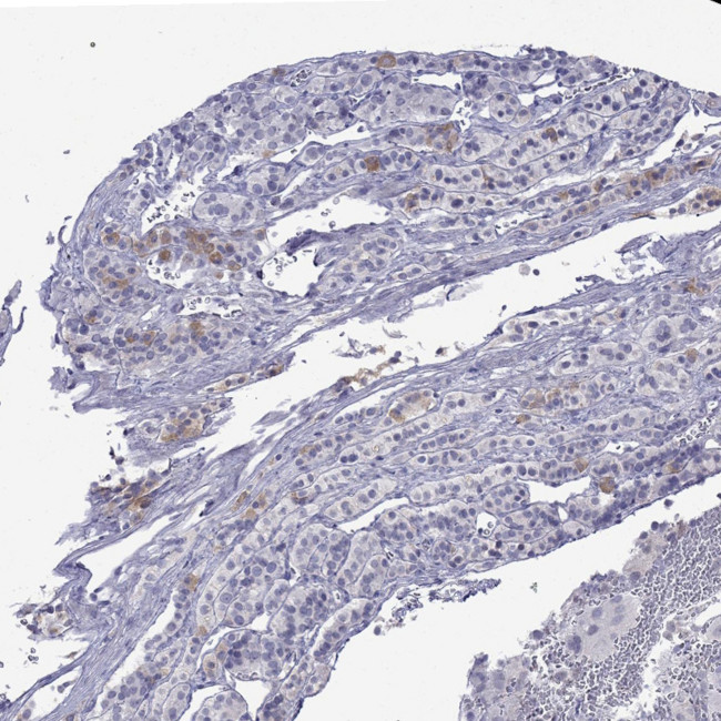 MYO15A Antibody in Immunohistochemistry (Paraffin) (IHC (P))