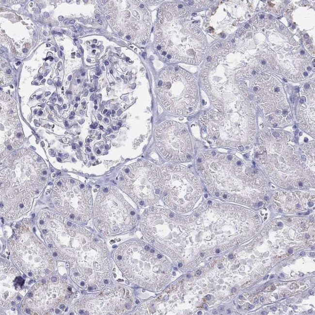 ALOXE3 Antibody in Immunohistochemistry (Paraffin) (IHC (P))