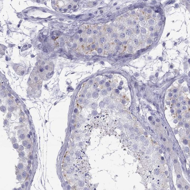 MAEL Antibody in Immunohistochemistry (Paraffin) (IHC (P))
