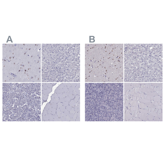 TBR1 Antibody in Immunohistochemistry (Paraffin) (IHC (P))