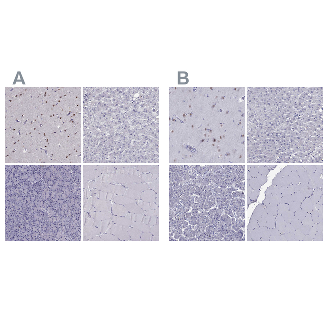 TBR1 Antibody in Immunohistochemistry (Paraffin) (IHC (P))