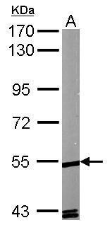 RORA Antibody in Western Blot (WB)