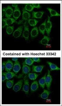 alpha-1a Adrenergic Receptor Antibody in Immunocytochemistry (ICC/IF)