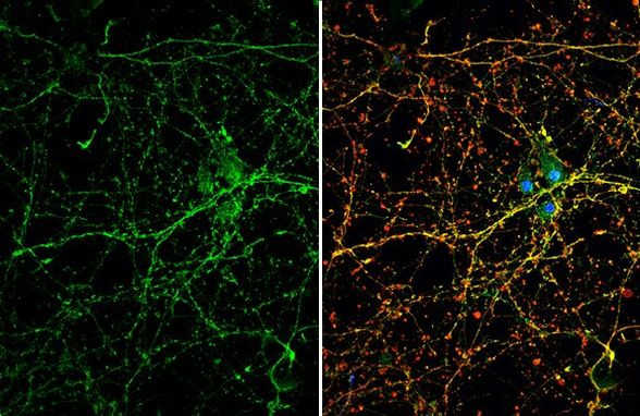 DRD1 Antibody in Immunocytochemistry (ICC/IF)