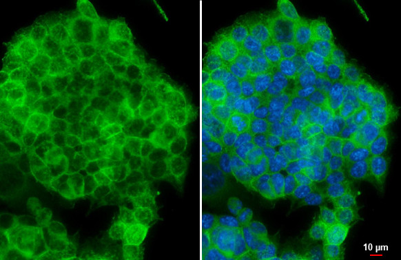 E-cadherin Antibody in Immunocytochemistry (ICC/IF)