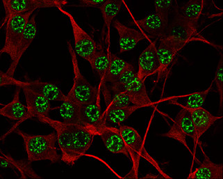 SOD1 Antibody in Immunocytochemistry (ICC/IF)