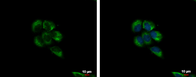 Metadherin Antibody in Immunocytochemistry (ICC/IF)