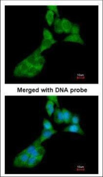 MMP3 Antibody in Immunocytochemistry (ICC/IF)