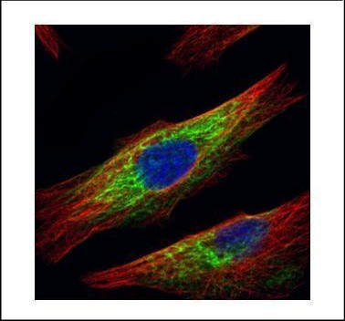 HDAC6 Antibody in Immunocytochemistry (ICC/IF)