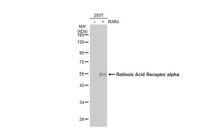 RARA Antibody in Western Blot (WB)