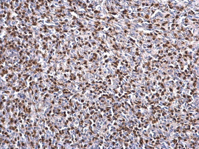 Zap-70 Antibody in Immunohistochemistry (Paraffin) (IHC (P))