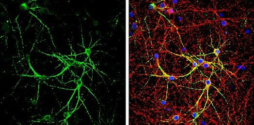 E6AP Antibody in Immunocytochemistry (ICC/IF)