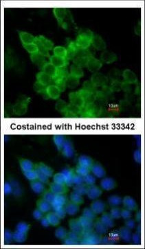 LPL Antibody in Immunocytochemistry (ICC/IF)
