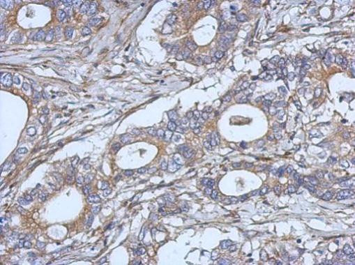 IL-2 Antibody in Immunohistochemistry (Paraffin) (IHC (P))