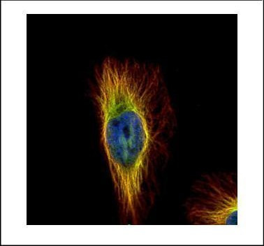 beta Tubulin Antibody in Immunocytochemistry (ICC/IF)