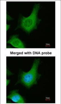 Calcium Sensing Receptor Antibody in Immunocytochemistry (ICC/IF)