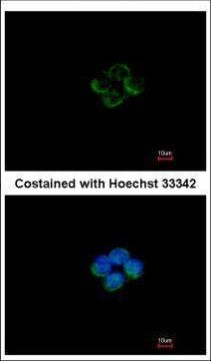 ACADM Antibody in Immunocytochemistry (ICC/IF)
