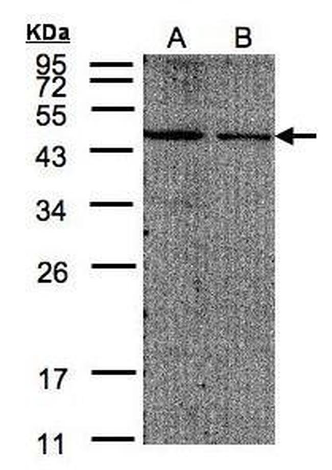 eIF4A2 Antibody in Western Blot (WB)