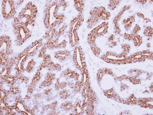 CD123 Antibody in Immunohistochemistry (Paraffin) (IHC (P))