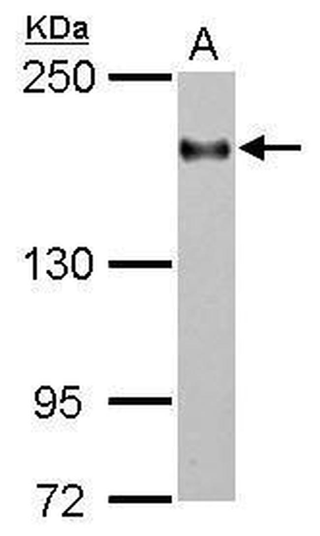 CD11a Antibody in Western Blot (WB)