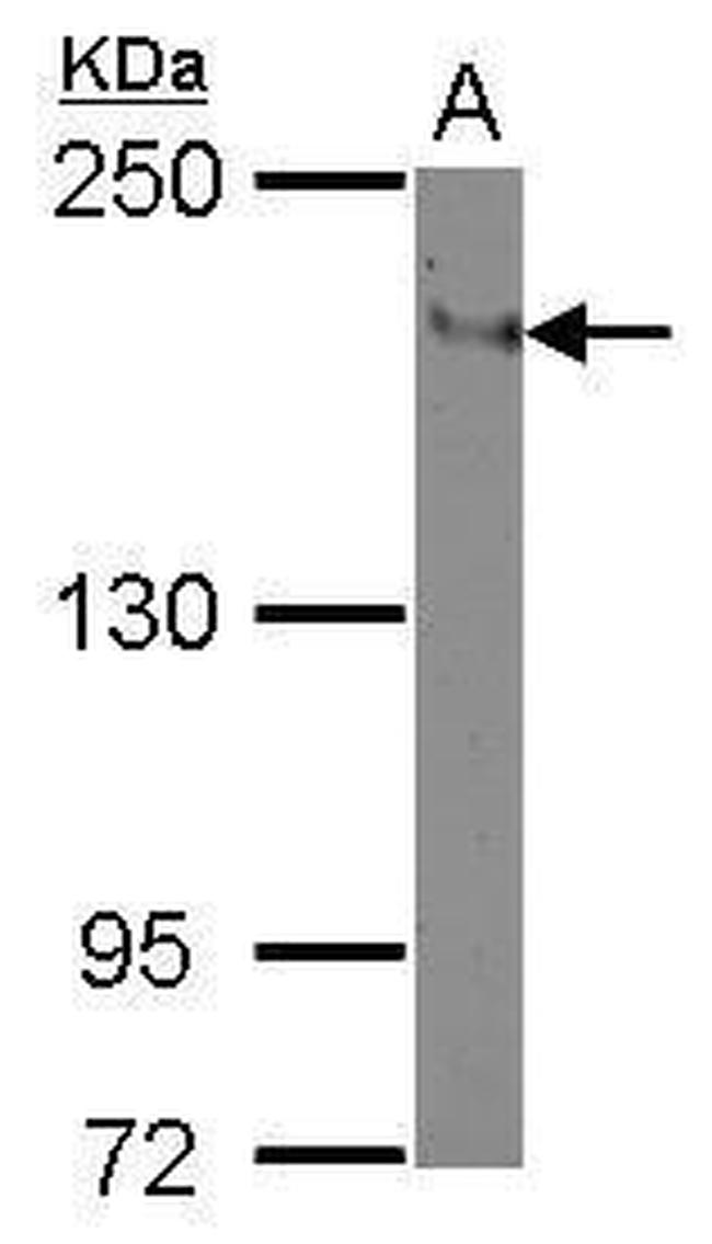 CD11a Antibody in Western Blot (WB)