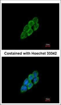 LTBP4 Antibody in Immunocytochemistry (ICC/IF)