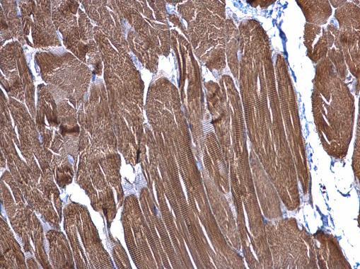 alpha-Cardiac Actin Antibody in Immunohistochemistry (Paraffin) (IHC (P))